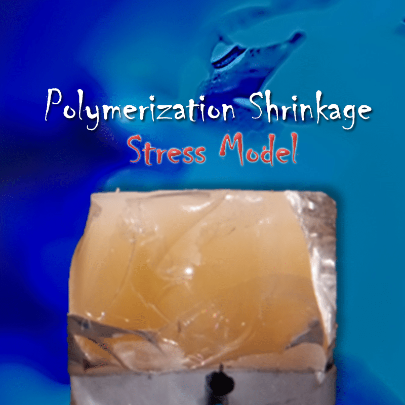Visualizing Polymerization Shrinkage and Stress