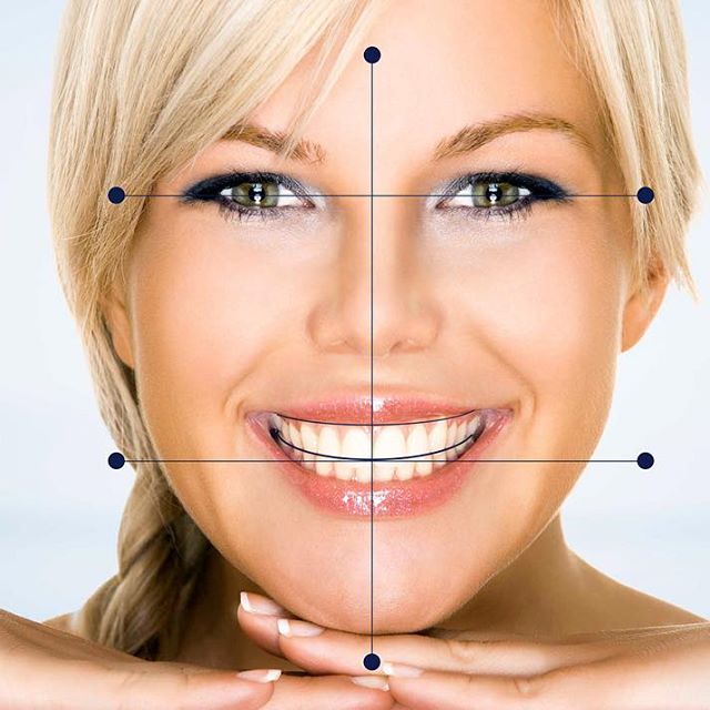 Digital Dentistry – 3D Printing & Smile Design